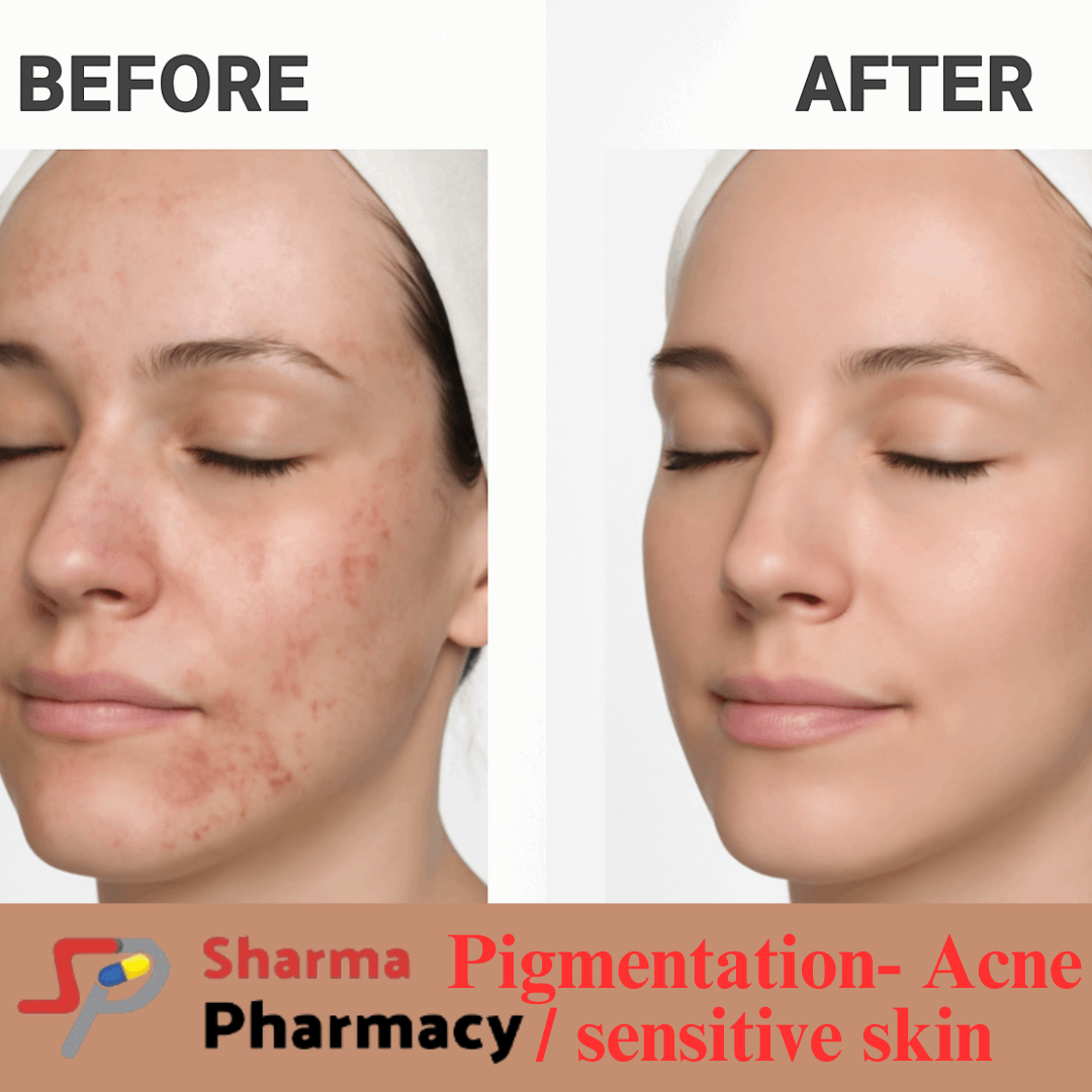Pigmentation- Acne / sensitive skin Product Box