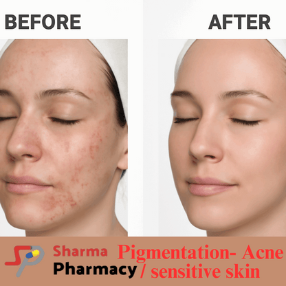 Pigmentation- Acne / sensitive skin Product Box