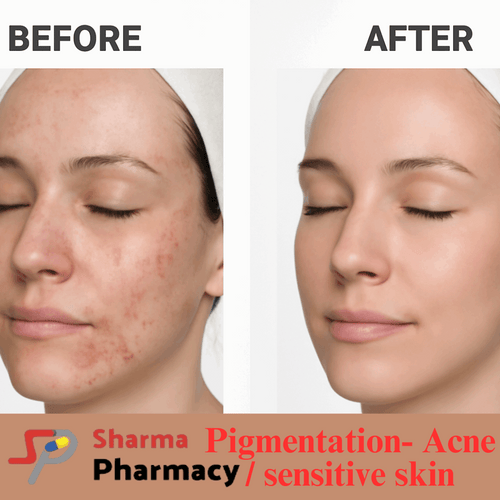 Pigmentation- Acne / sensitive skin Product Box
