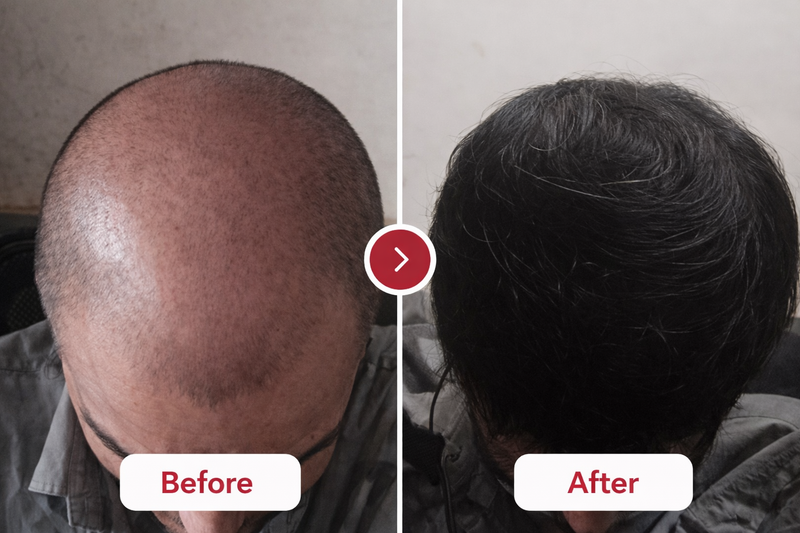 Before and After Results