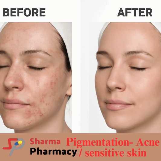 Pigmentation- Acne / sensitive skin ( maintenance)