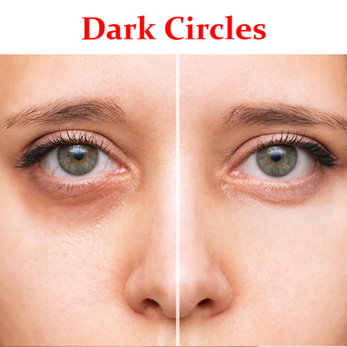 Dark Circles-Combo Pack