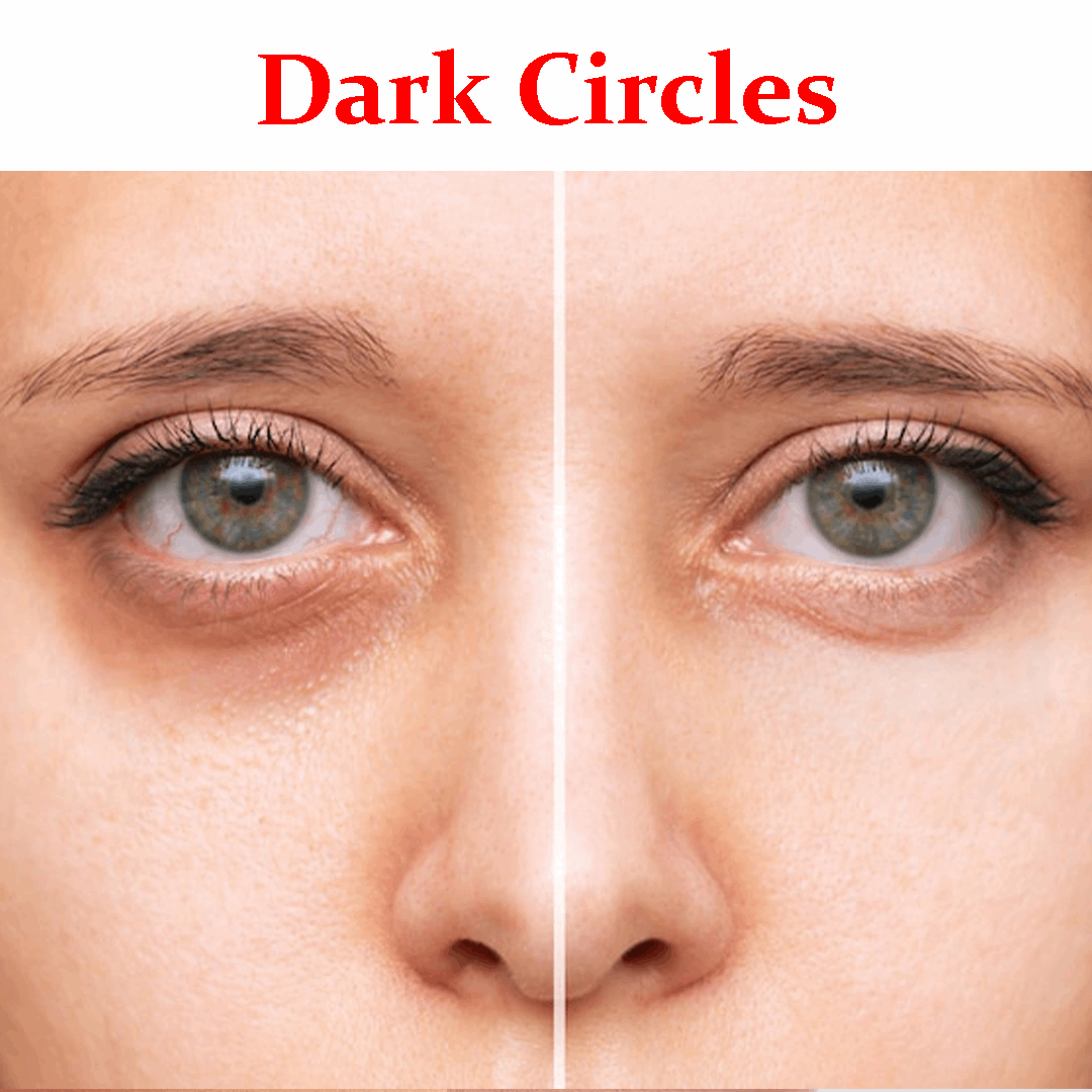 Dark circles- Product Box
