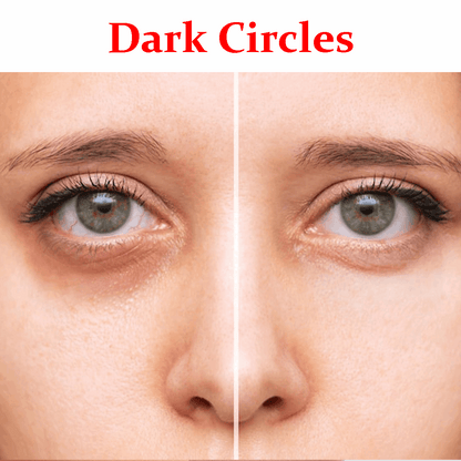 Dark circles- Product Box