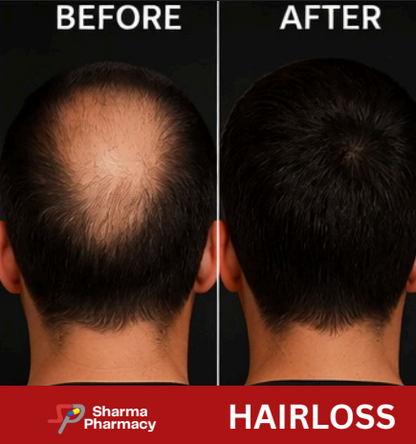 Hairloss- Product Box