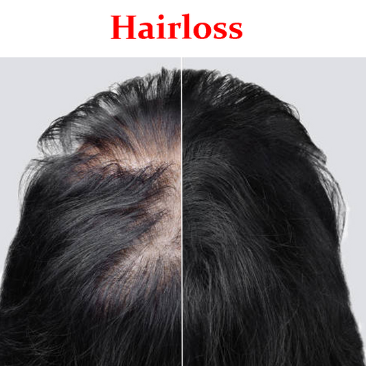 hair loss