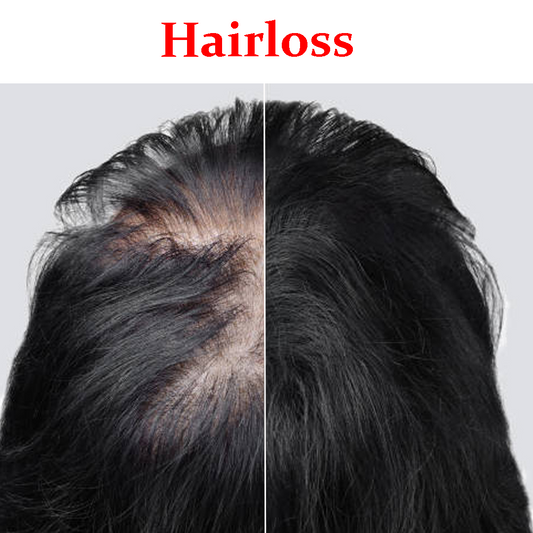 Hair loss Maintenance Treatment