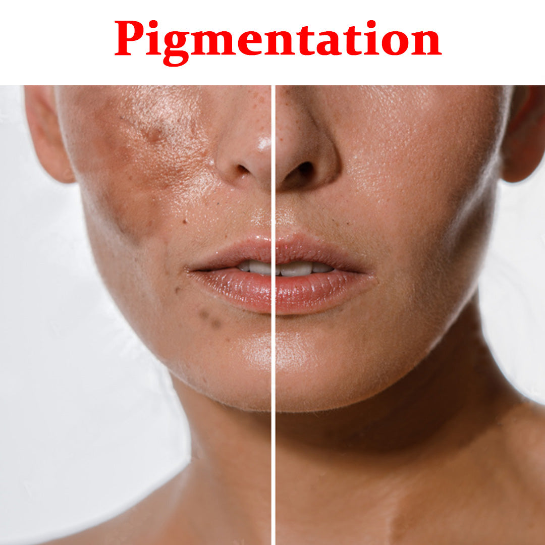 Pigmentation- Product Box