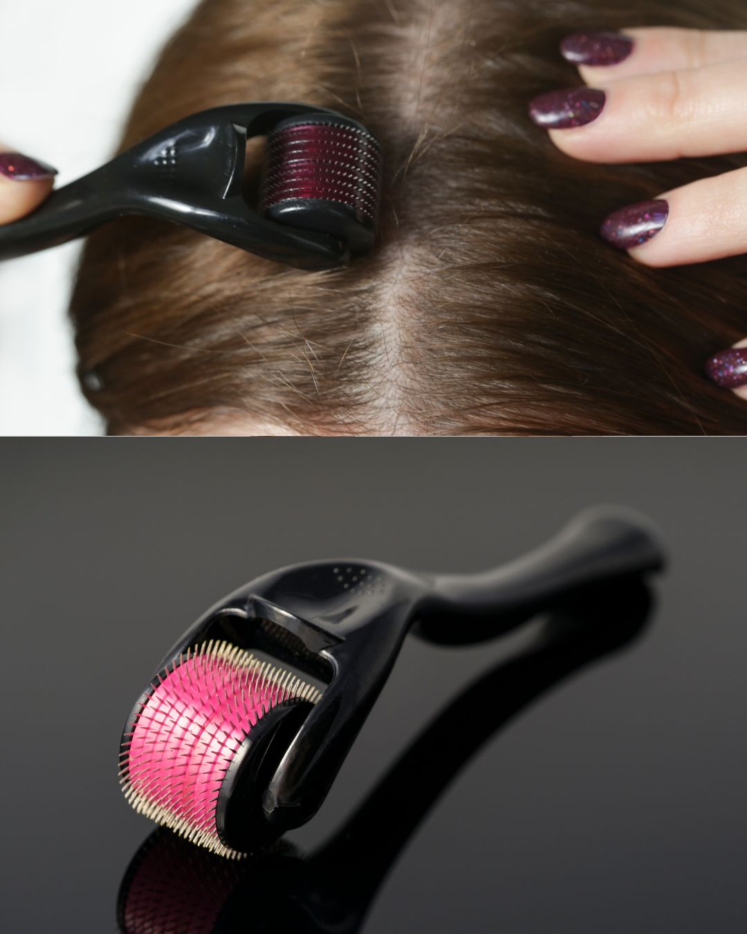 DERMA ROLLER