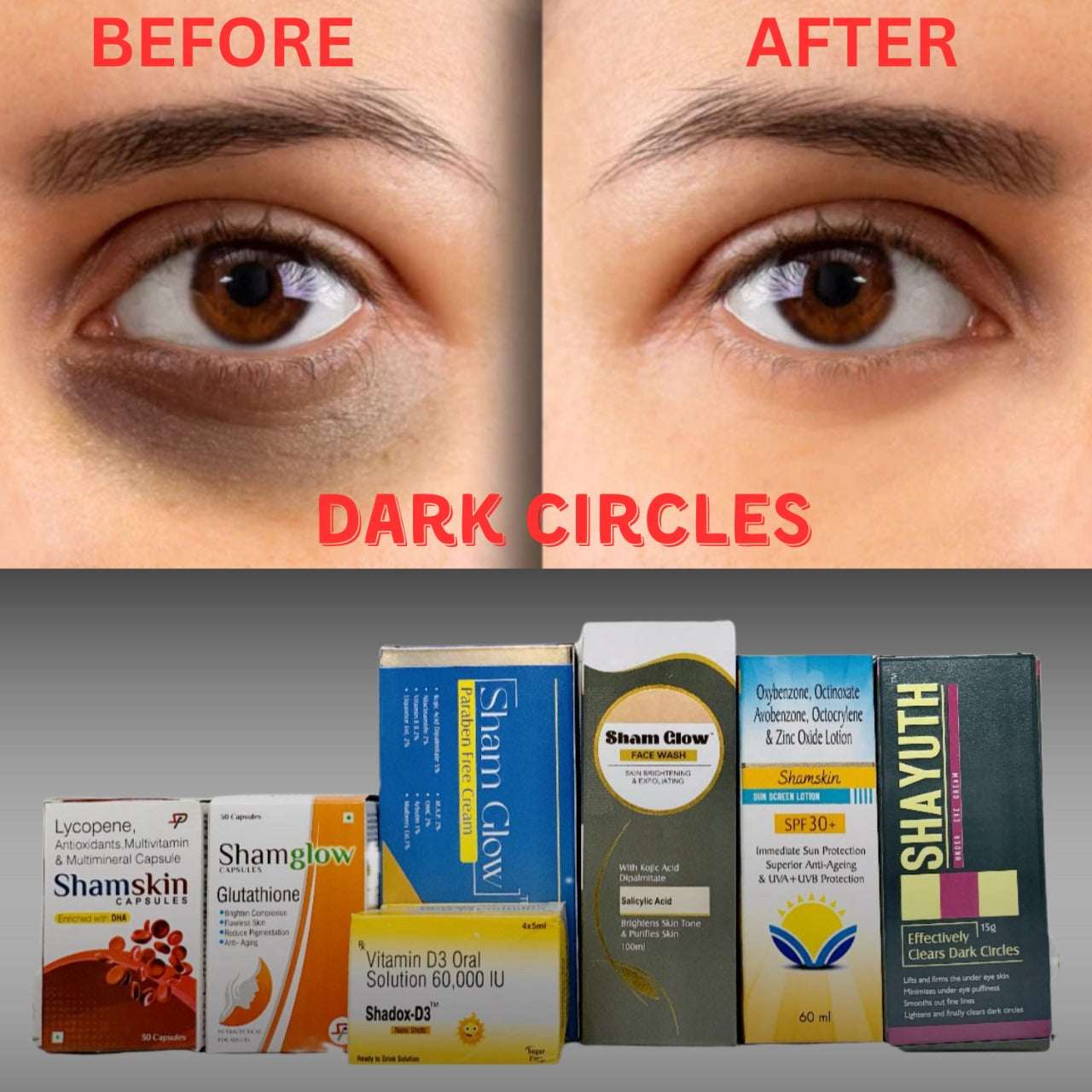 Dark circles- Product Box