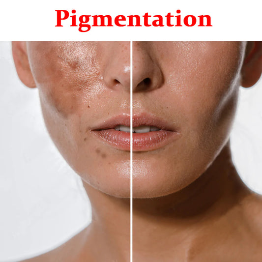 pigmentation 