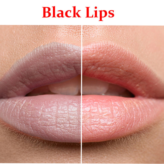 Black Lips- Product Box
