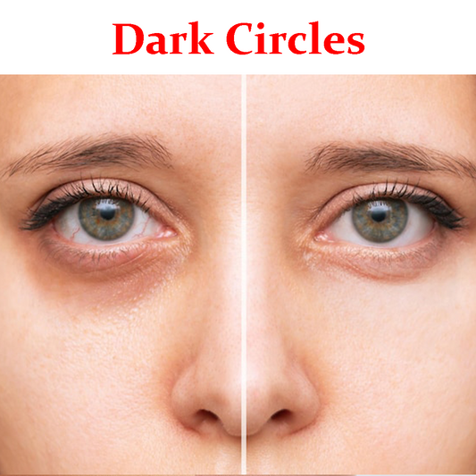 Dark circles- Product Box