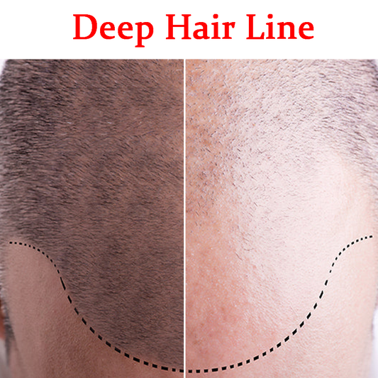 Deep Hair Line- Product Box