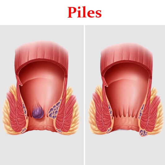 Piles- Product Box